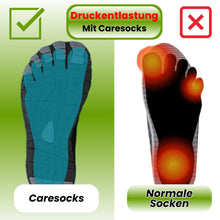 Lade das Bild in den Galerie-Viewer, Caresocks orthopädische Kompressionsstrümpfe - verhindert Krampfadern &amp; entlastet müde Füße - Sonderaktion
